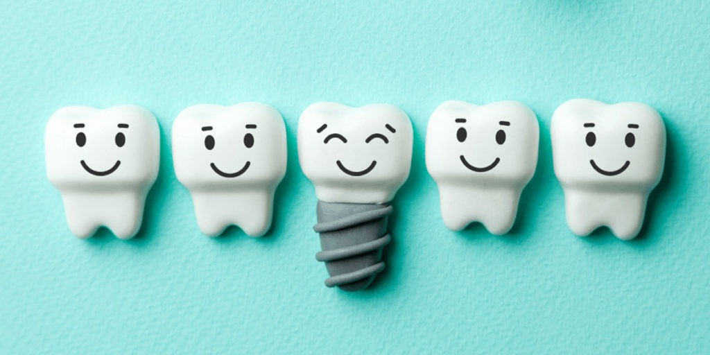Dental implant with a happy tooth